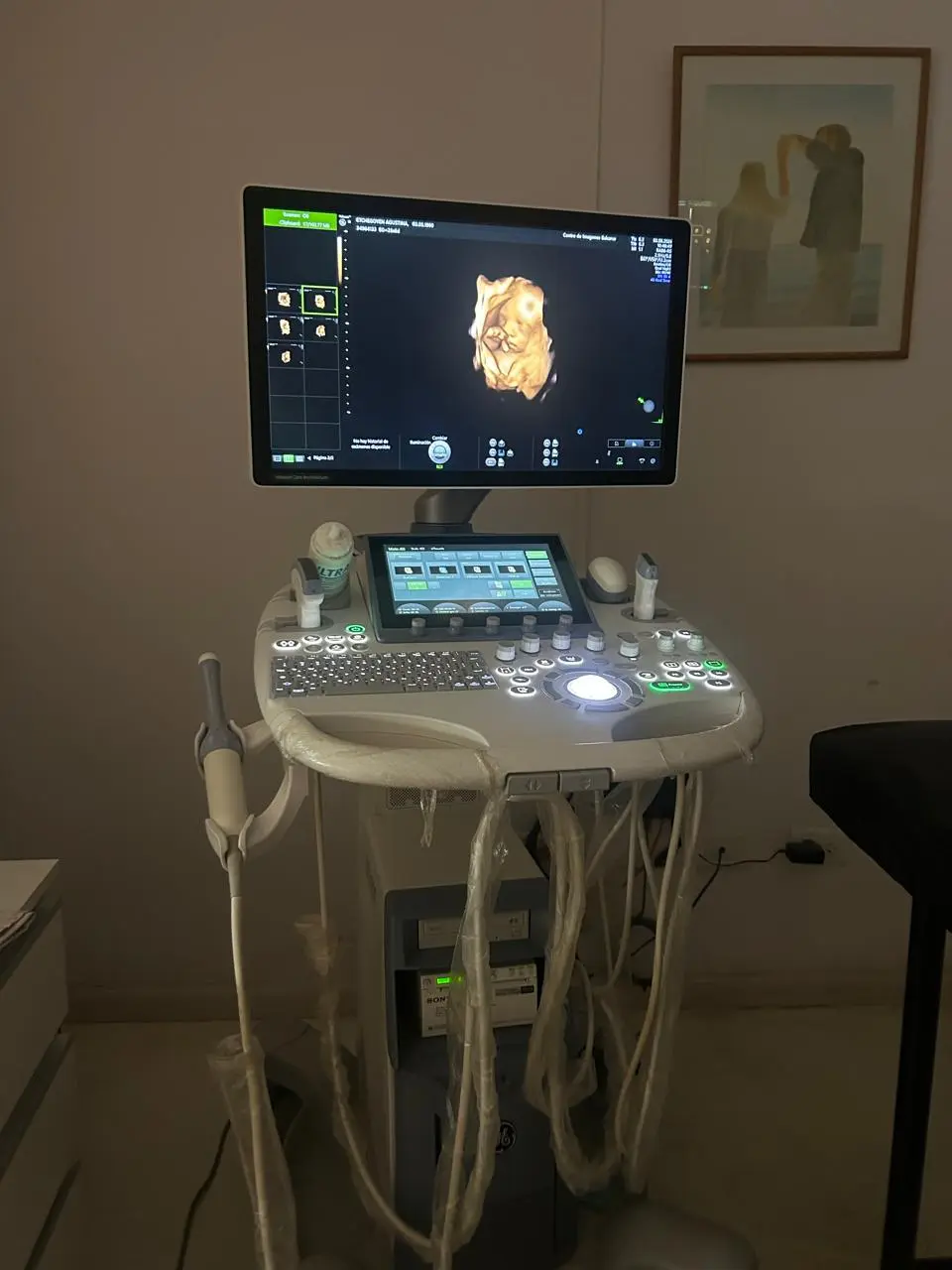 Ecógrafo con imagen 3D