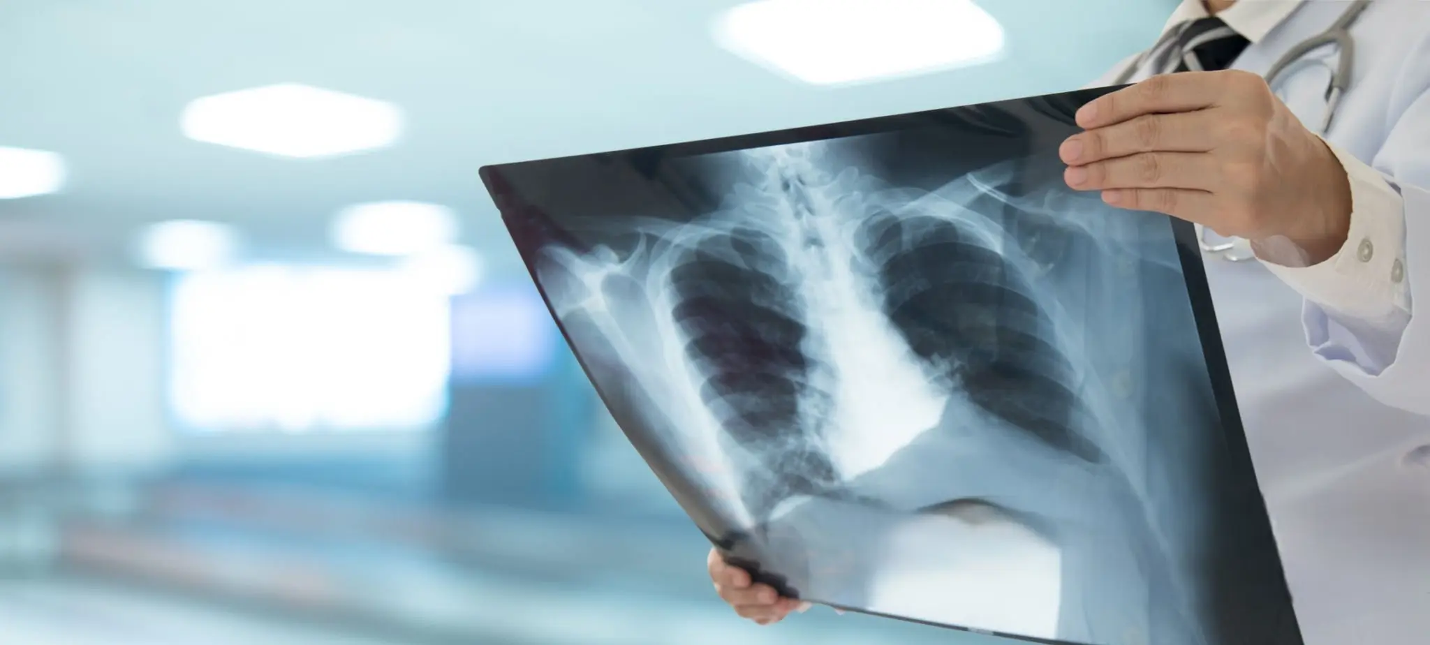 Radiología Digital - Centro de Imágenes Balcarce